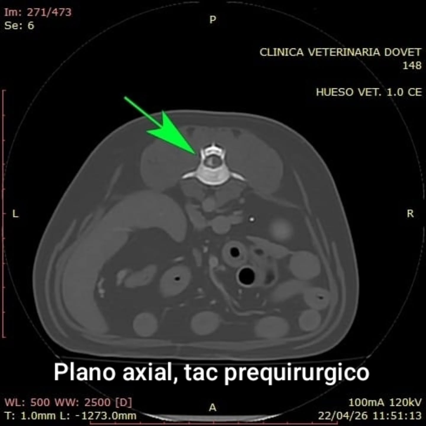 Hemilaminectomía en perros: cirugía para la compresión medular